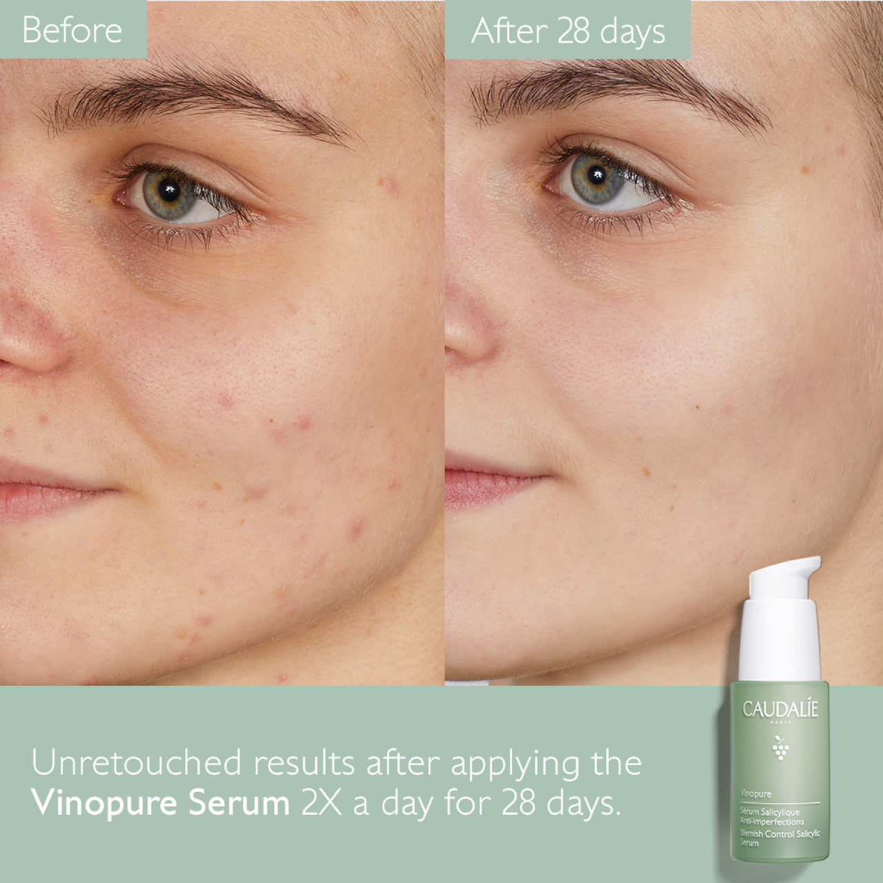 Caudalíe - Vinopure Pore Minimizing Salicylic Acid