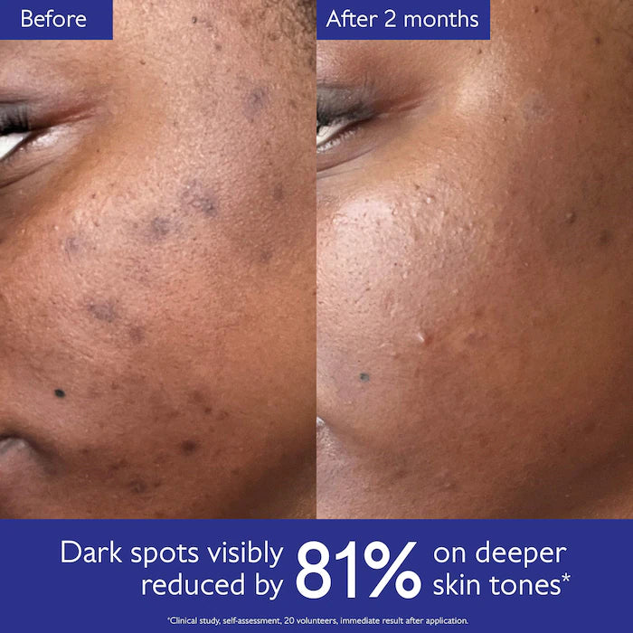 Caudalie 
Vinoperfect Brightening Dark Spot Serum Vitamin C Alternative