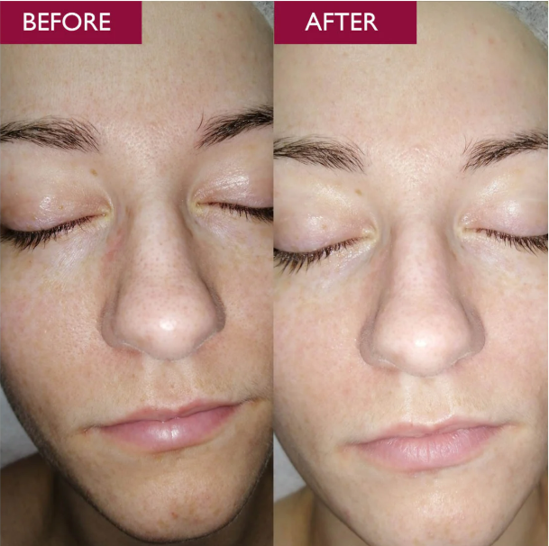 THE ORDINARY - GLYCOLIC ACID 7% TONNING SOLUTION